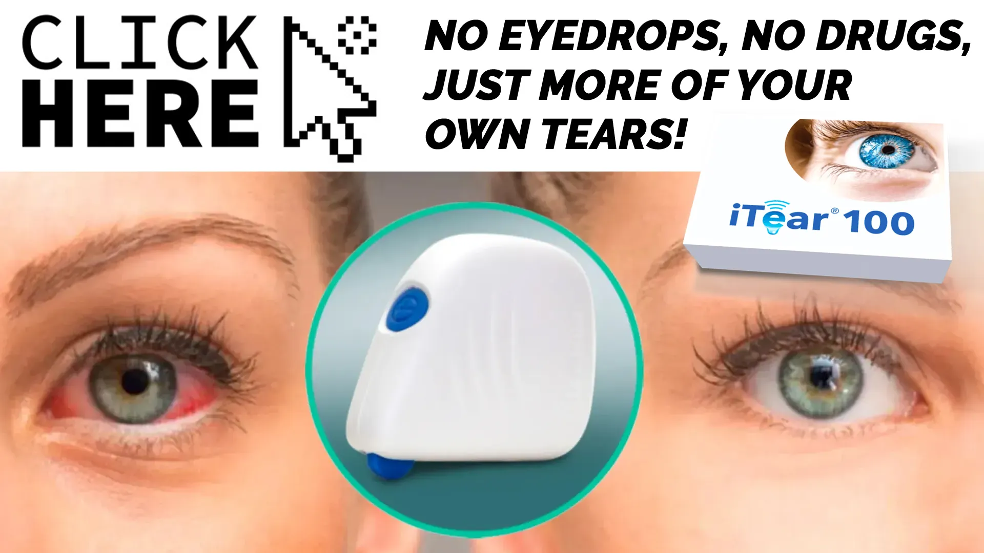 Treating Dry Eye Syndrome: Conventional Solutions and the iTEAR100 Revolution