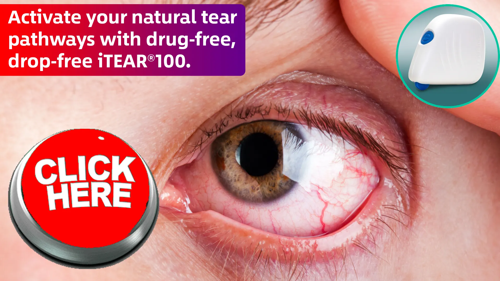 The iTear100 Advantage: Revolutionizing Eye Care